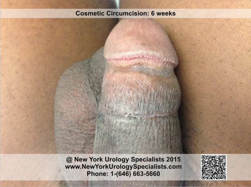 naked male action figure with penis black women with big breast fucking