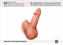 Small penis that create one