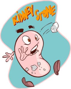 Kidney Stones