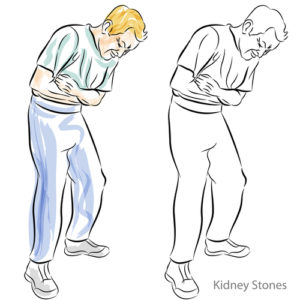 Renal colic from kidney stones