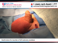 Small incision for insertion of left testicular prosthesis