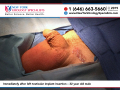 Immediately after left testicular implant insertion – 32 year old male