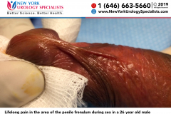 5165a_Lifelong-pain-in-the-area-of-the-penile-frenulum-during-sex-in-a-26-year-old-male 5165a_Lifelong-pain-in-the-area-of-the-penile-frenulum-during-sex-in-a-26-year-old-male