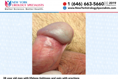 5751_38-year-old-man-with-lifelong-tightness-and-pain-with-erections 5751_38-year-old-man-with-lifelong-tightness-and-pain-with-erections