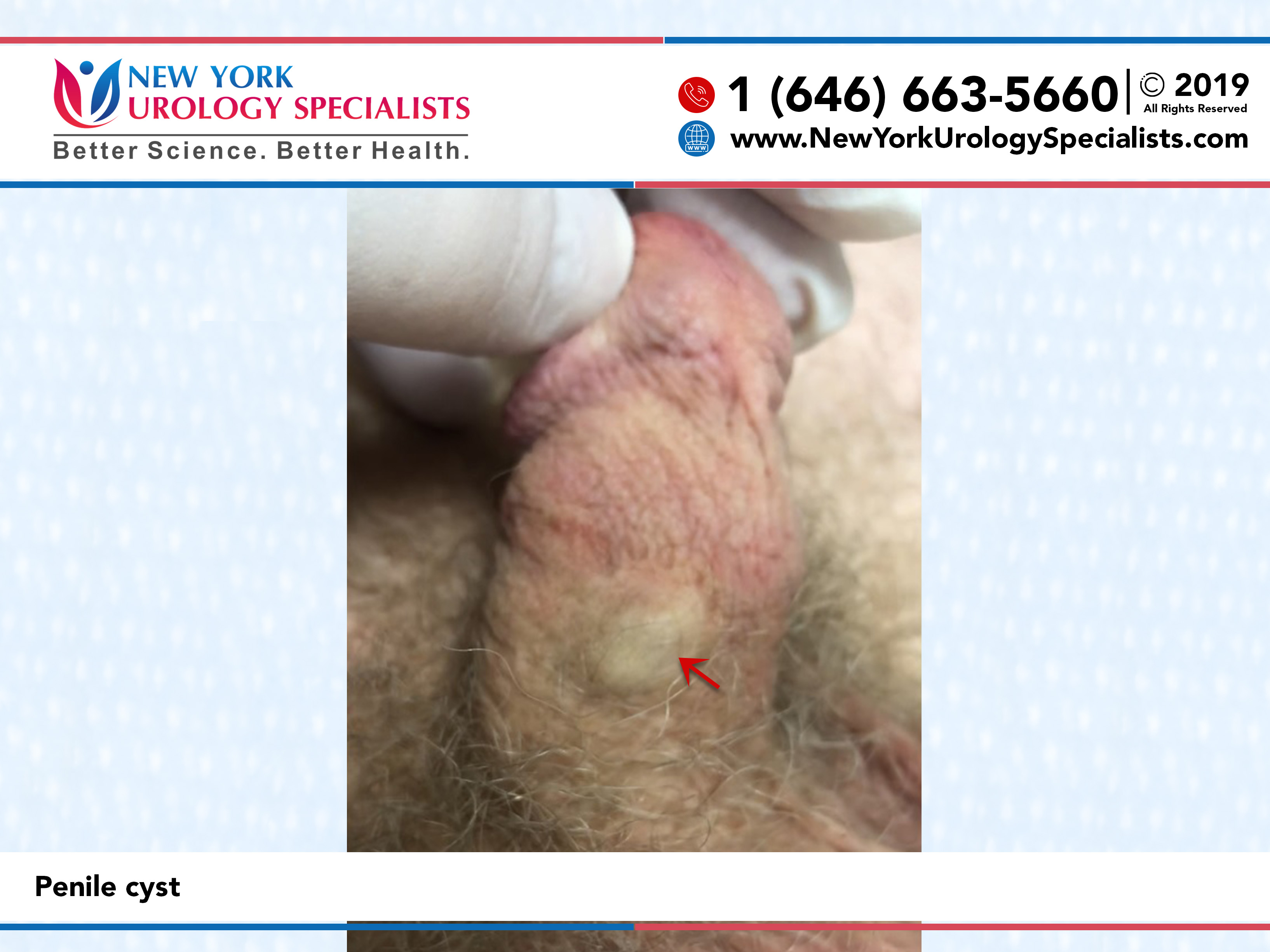 صورة زب عريض